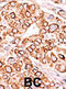 1-phosphatidylinositol-3-phosphate 5-kinase antibody, abx033209, Abbexa, Immunohistochemistry frozen image 