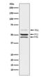 SHC-transforming protein 1 antibody, M00796-1, Boster Biological Technology, Western Blot image 