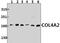 Collagen Type IV Alpha 2 Chain antibody, PA5-75303, Invitrogen Antibodies, Western Blot image 