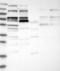 Centrobin, Centriole Duplication And Spindle Assembly Protein antibody, NBP1-82837, Novus Biologicals, Western Blot image 