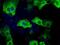 Transforming Acidic Coiled-Coil Containing Protein 3 antibody, GTX83529, GeneTex, Immunofluorescence image 