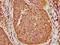 Keratin 16 antibody, CSB-PA012515LA01HU, Cusabio, Immunohistochemistry paraffin image 