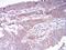 Histone Deacetylase 4 antibody, NBP2-52480, Novus Biologicals, Immunohistochemistry paraffin image 