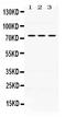 Interleukin 2 Receptor Subunit Beta antibody, PB9761, Boster Biological Technology, Western Blot image 
