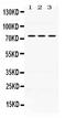 Interleukin 2 Receptor Subunit Beta antibody, PB9761, Boster Biological Technology, Western Blot image 