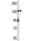 ERBB2 antibody, F44324-0.4ML, NSJ Bioreagents, Western Blot image 