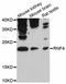 E3 ubiquitin ligase RNF4 antibody, abx126488, Abbexa, Western Blot image 