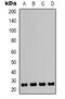 High Mobility Group Box 1 antibody, orb338860, Biorbyt, Western Blot image 