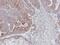 JNK1 + JNK2 antibody, PA5-28262, Invitrogen Antibodies, Immunohistochemistry paraffin image 