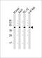 Thyroid Hormone Receptor Alpha antibody, 61-243, ProSci, Western Blot image 