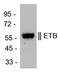 Endothelin Receptor Type B antibody, PA3-066, Invitrogen Antibodies, Western Blot image 