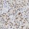 NOP2/Sun RNA Methyltransferase 2 antibody, FNab05870, FineTest, Immunohistochemistry paraffin image 