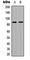 E3 ubiquitin-protein ligase RFWD3 antibody, abx121703, Abbexa, Western Blot image 