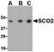 SCO Cytochrome C Oxidase Assembly Protein 2 antibody, LS-B548, Lifespan Biosciences, Western Blot image 