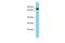 Golgi Associated, Gamma Adaptin Ear Containing, ARF Binding Protein 2 antibody, PA5-45523, Invitrogen Antibodies, Western Blot image 