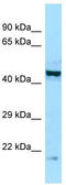 Eukaryotic Translation Initiation Factor 2B Subunit Beta antibody, TA338094, Origene, Western Blot image 