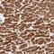 MLC-2 antibody, PA5-58718, Invitrogen Antibodies, Immunohistochemistry paraffin image 