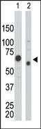 Pyruvate Kinase M1/2 antibody, AP13595PU-N, Origene, Western Blot image 