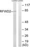 COP1 E3 Ubiquitin Ligase antibody, PA5-39149, Invitrogen Antibodies, Western Blot image 