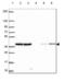 VPS26, Retromer Complex Component A antibody, NBP2-49257, Novus Biologicals, Western Blot image 