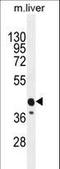 Calcium Voltage-Gated Channel Auxiliary Subunit Gamma 8 antibody, LS-B9612, Lifespan Biosciences, Western Blot image 