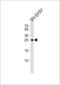 Regenerating Family Member 3 Gamma antibody, LS-B10435, Lifespan Biosciences, Western Blot image 