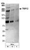 Thyroid Hormone Receptor Interactor 12 antibody, A301-814A, Bethyl Labs, Western Blot image 