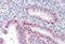  antibody, NB100-93417, Novus Biologicals, Immunohistochemistry paraffin image 
