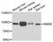 Inhibitor Of Nuclear Factor Kappa B Kinase Subunit Beta antibody, LS-C746752, Lifespan Biosciences, Western Blot image 