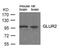 Glutamate Ionotropic Receptor AMPA Type Subunit 2 antibody, 79-607, ProSci, Western Blot image 