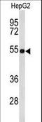 EFEMP2 antibody, LS-C167643, Lifespan Biosciences, Western Blot image 