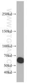 Integrin Subunit Alpha 6 antibody, 20232-1-AP, Proteintech Group, Western Blot image 