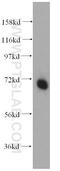 Poly(A) Polymerase Beta antibody, 12821-1-AP, Proteintech Group, Western Blot image 