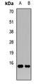 Glutamyl-TRNA Amidotransferase Subunit C antibody, orb412807, Biorbyt, Western Blot image 