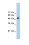 Ferrochelatase antibody, NBP1-54840, Novus Biologicals, Western Blot image 