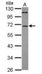 ST6 N-Acetylgalactosaminide Alpha-2,6-Sialyltransferase 1 antibody, NBP2-20493, Novus Biologicals, Western Blot image 