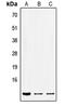 Protein transport protein Sec61 subunit beta antibody, LS-C353809, Lifespan Biosciences, Western Blot image 