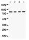 Sp4 Transcription Factor antibody, PB9558, Boster Biological Technology, Western Blot image 