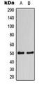 Calcium/Calmodulin Dependent Protein Kinase II Alpha antibody, MBS8202794, MyBioSource, Western Blot image 