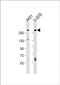 Neuroblastoma Amplified Sequence antibody, PA5-49534, Invitrogen Antibodies, Western Blot image 