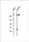 Neuroblastoma-amplified sequence antibody, PA5-49534, Invitrogen Antibodies, Western Blot image 