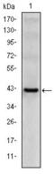 Killer Cell Lectin Like Receptor D1 antibody, GTX60406, GeneTex, Western Blot image 