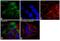 Keratin 5 antibody, MA5-14473, Invitrogen Antibodies, Immunofluorescence image 