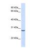 Tetraspanin 6 antibody, NBP1-59047, Novus Biologicals, Western Blot image 