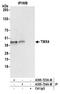 Thioredoxin Related Transmembrane Protein 4 antibody, A305-723A-M, Bethyl Labs, Immunoprecipitation image 