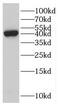 Epithelial Stromal Interaction 1 antibody, FNab02821, FineTest, Western Blot image 