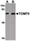 Mitochondrial import receptor subunit TOM70 antibody, PA5-20654, Invitrogen Antibodies, Western Blot image 