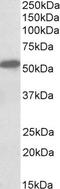 Cannabinoid Receptor 1 antibody, EB10961, Everest Biotech, Western Blot image 