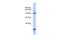 Membrane Integral NOTCH2 Associated Receptor 1 antibody, A18104, Boster Biological Technology, Western Blot image 