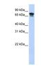 Kinesin Family Member 22 antibody, NBP1-58125, Novus Biologicals, Western Blot image 